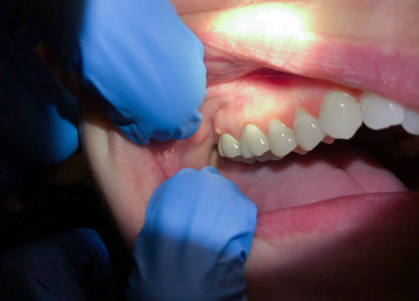 Best Walk-In Emergency Dental Services in Riverview, SC